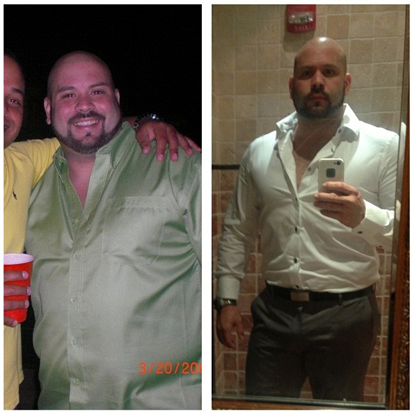 Before and After - Damaso Diaz